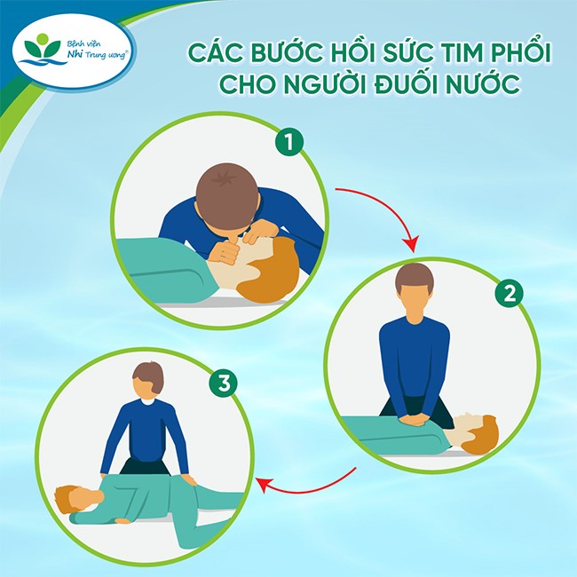 Hướng dẫn các bước cấp cứu tại chỗ trẻ đuối nước  - Ảnh 1.