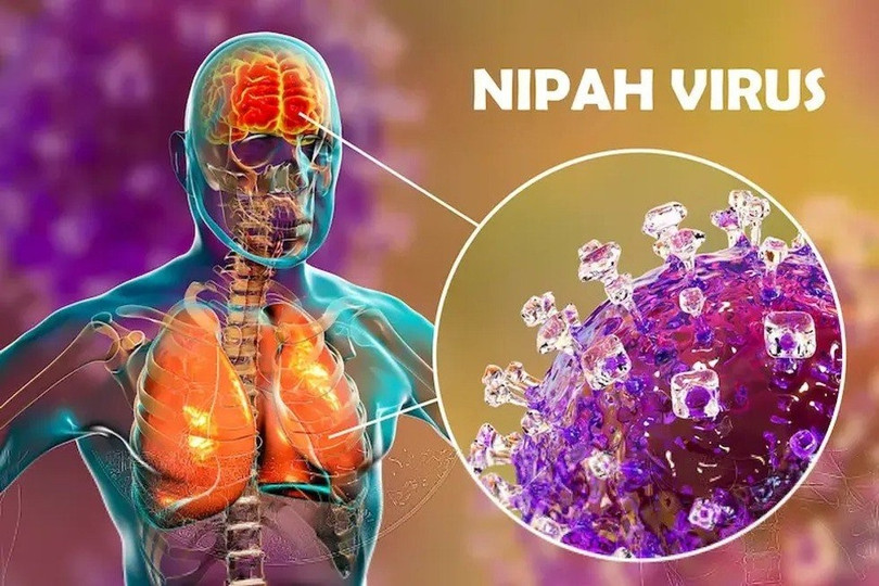 Virus Nipah là tác nhân truyền nhiễm nguy hiểm, tỉ lệ tử vong cao, chuyên gia khuyến cáo các biện pháp ứng phó- Ảnh 2. Virus Nipah là tác nhân truyền nhiễm nguy hiểm, tỉ lệ tử vong cao, chuyên gia khuyến cáo các biện pháp ứng phó- Ảnh 2.