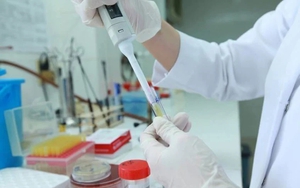 Sửa quy định chế độ bồi dưỡng giám định tư pháp